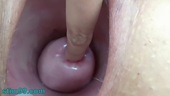 Gonzo Đức: Niềm Vui Độc Đáo Với Lưới Và Hoa Cần